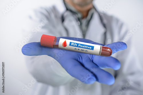 Rh-Positive blood test. Blood sample with Rh-Positive result.