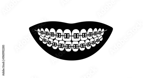 A minimalist black and white graphic illustration of a smiling mouth showing metal dental braces