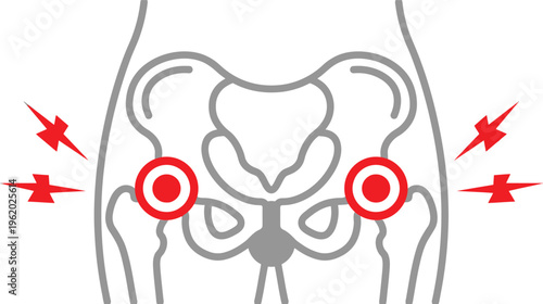 Vector graphic illustration of a pelvis with highlighted hip joints and lightning bolts indicating pain
