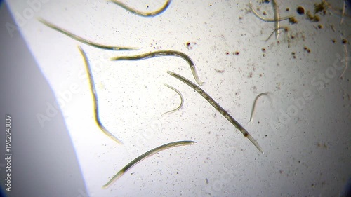 Low motility nematodes in turbid water under 40x bright field microscopy. 4K scientific microscopy footage.