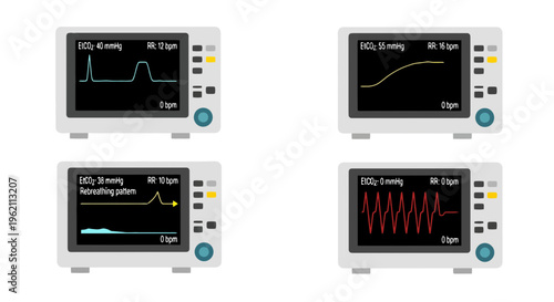 Set of 4 Capnography Medical Monitors Displaying EtCO2 Waveforms and Respiratory Rate for Anesthesia and Patient Vital Signs Monitoring