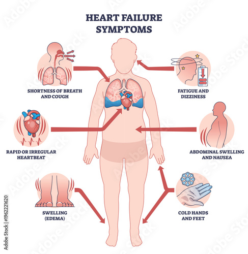 Heart failure symptoms overview shows a human silhouette with heart and lungs, arrows highlighting breathlessness, edema, and fatigue for quick patient education. Outline diagram
