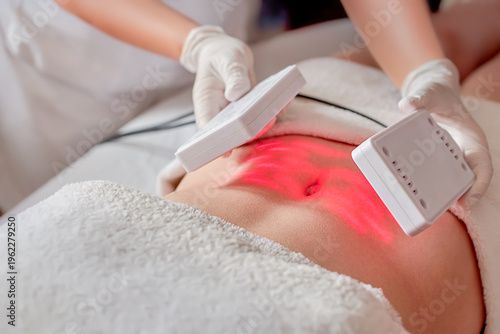 Cuadro en lienzo Laser lipolysis procedure on a girl's stomach
