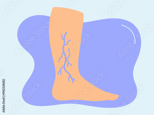 Stylized of a human leg with visible blue veins against a soft purple and light blue background