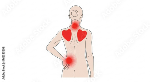 A vector graphic illustration of a person with back pain and red highlighted areas