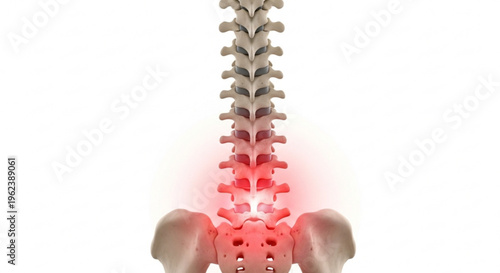 A medical illustration of a human spine with a highlighted lower back pain area