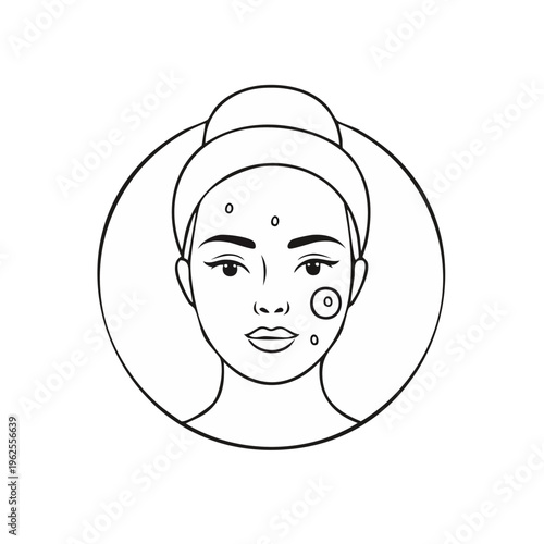 Close up of a young woman's face showing blemishes and pimples in a medical illustration style.