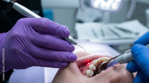 Dentist using laser treatment on patient's teeth during a dental procedure.