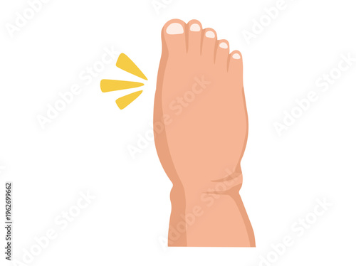 Hand Drawn Edema Foot Disease Illustration

