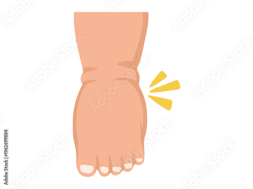 Edema Foot Healthcare Illustration
