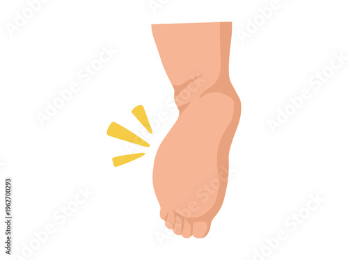 Edema or Swollen Foot Illustration
