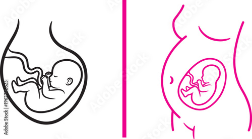Two minimalist line art illustrations depicting a fetus in the womb. The left shows a fetus within a stylized uterus, while the right features a pink outline of a pregnant woman's torso.