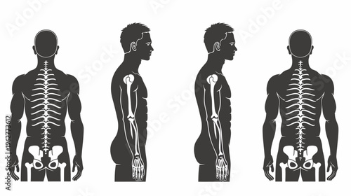 Male anatomy silhouettes, frontal and profile views, showing bone structure overlay