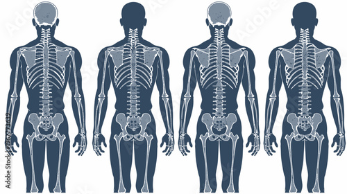 Four silhouettes display the human skeletal system from the back view