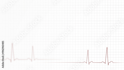 Clean medical background featuring a subtle ECG grid with a heartbeat line transitioning from blurred signals on the left to a sharp, clear cardiogram on the right.