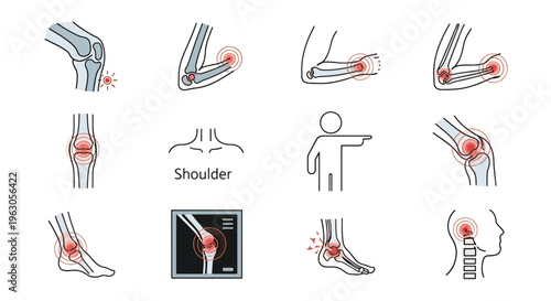 Human body pain points diagram with red markers on joints and muscles