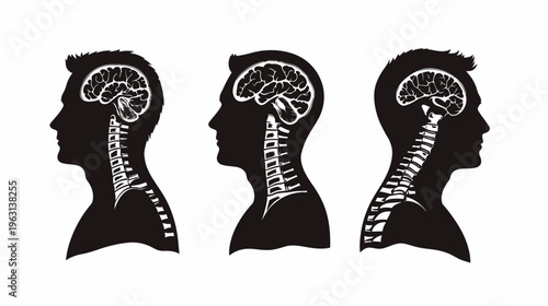 Silhouettes of human heads, showcasing brain and spinal cord anatomy, in profile