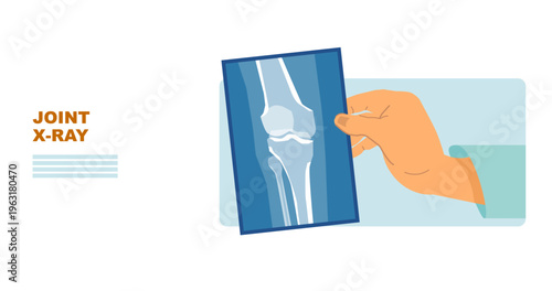 Doctor Holding Joint X-Ray Scan – Orthopedic Diagnosis and Bone Injury Concept Illustration, Medical X-Ray Set