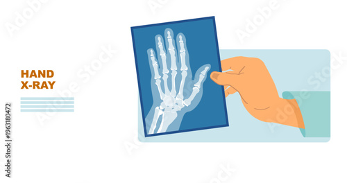 Doctor Holding Hand X-Ray Scan – Medical Radiology Vector Illustration for Healthcare Landing Page, Medical X-Ray Set