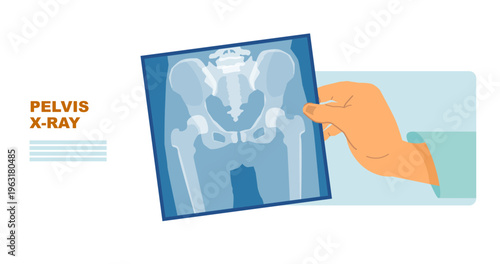 Doctor Holding Pelvis X-Ray Scan – Orthopedic Radiology Vector Illustration for Medical Website, Medical X-Ray Set