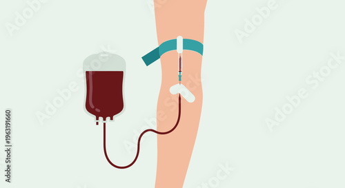 Blood transfusion, medical IV drip, healthcare illustration, vein arm isolated on White Background