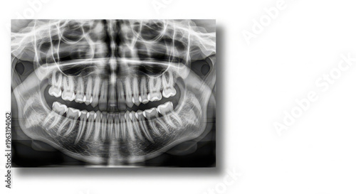 Detailed panoramic dental X-ray showing a full human jaw with teeth, capturing anatomical structures for diagnostic dentistry and oral health.
