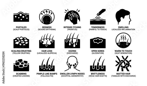 Scalp conditions: symptoms and signs illustrated