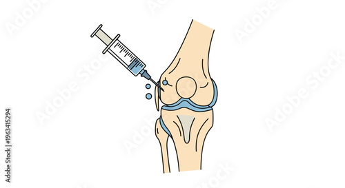 A detailed human knee joint is shown with a syringe injecting blue liquid drops into the front on a white background.