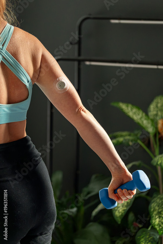 Diabetic young woman with glucose sensor and mobile phone measuring blood sugar level at home