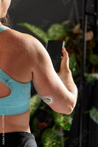Diabetic young woman with glucose sensor and mobile phone measuring blood sugar level at home