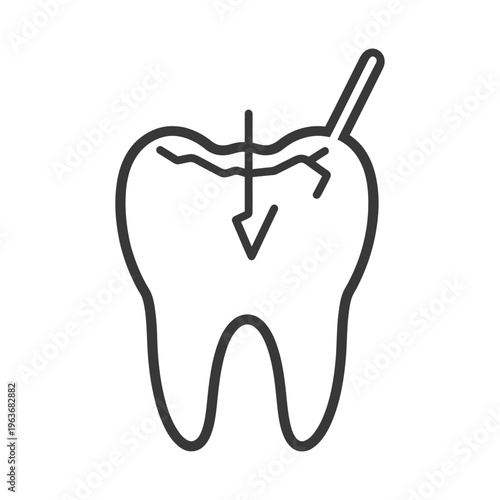 A damaged molar with cracks and a tool inserted into it