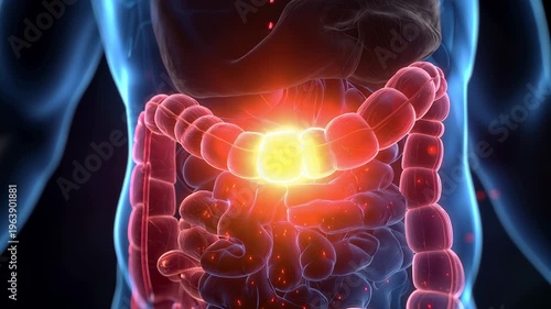Medical animation shows man's inflamed digestive system highlighting the impact of digestive health on overall well-being in a human body model