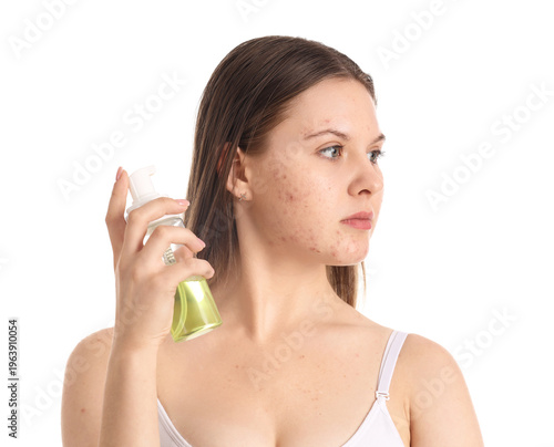 Teenage girl with acne prob...