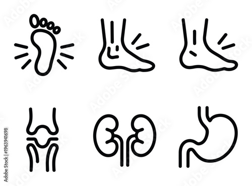 Medical Foot Pain, Ankle, Joint, Kidneys, and Stomach