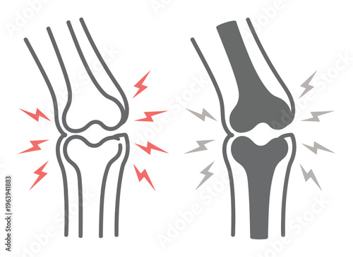 Of a healthy knee joint versus a painful knee joint with lightning bolts