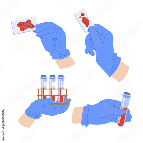 Set of hands blood tube analysis set collection. Bloods filling glass vial tubes in nurse hands gloves for medical hiv or diabetes test. Laboratory diagnosis medical clinic. Vector illustration