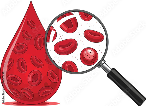 Detailed vector illustration depicting a large drop of red blood cells viewed under a magnifying glass for microscopic analysis