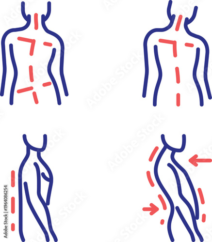Diagram of human nervous system pathways and reflex arcs in limbs and torso
