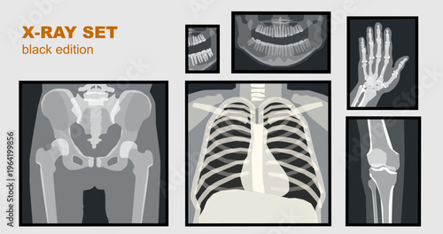 Medical X-Ray Set Black Edition, Radiology Vector Scans Collection for Healthcare UI and Landing Page Design
