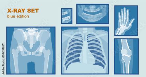 Medical X-Ray Set Blue Edition, Radiology Vector Scans Collection for Healthcare UI and Landing Page Design