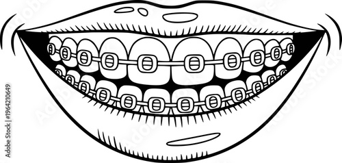 Black and white of a smiling mouth with dental braces white background smile teeth