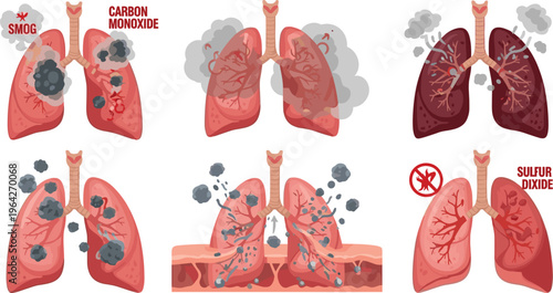 Smog, Carbon Monoxide, and Sulfur Dioxide Pollution Impact on Lungs, Showing Airborne Toxins and Lung Damage