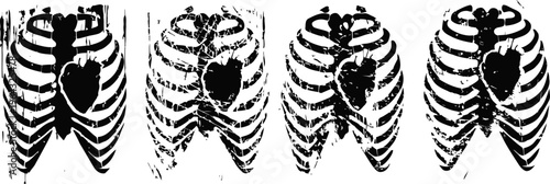 x ray chest showing ribcage and heart in various angles, medical diagnostic scans