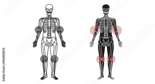 Human skeleton anatomy vector with joint pain highlights, medical illustration of bone structure and inflammation, body ache diagram for healthcare