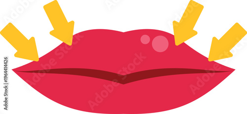 Lips with arrows pointing to areas for cosmetic filler enhancement