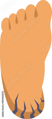 Detailed illustration of a human foot depicting cracked, dry skin on the heel area