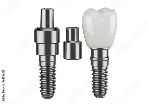 Dental implant abutment and screw for tooth restoration