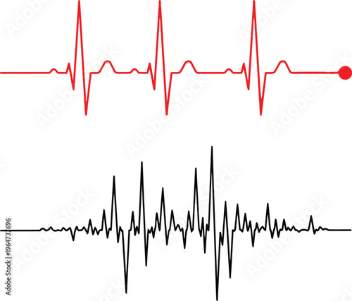 Fotografie A comparison between a normal regular heartbeat rhythm and an irregular erratic