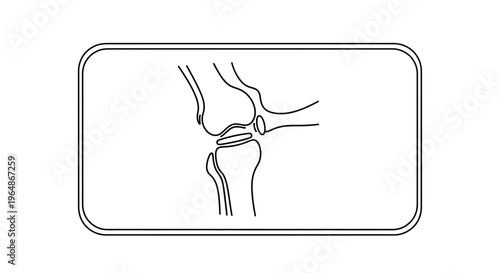 Human knee joint anatomical diagram illustrating bone structure and cartilage in simple line art