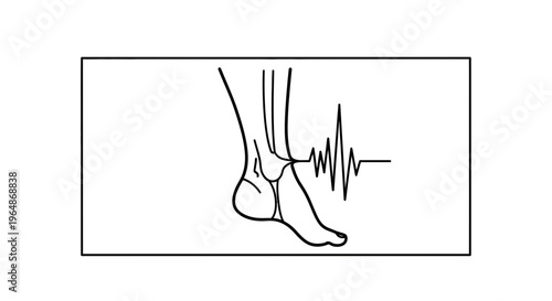 minimalist black and white drawing depicting an anatomical human foot with a dynamic pain indicator
